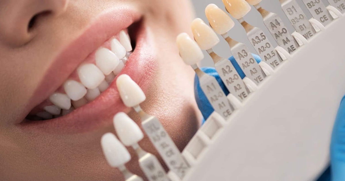 10-tips-for-strong-white-and-healthy-teeth